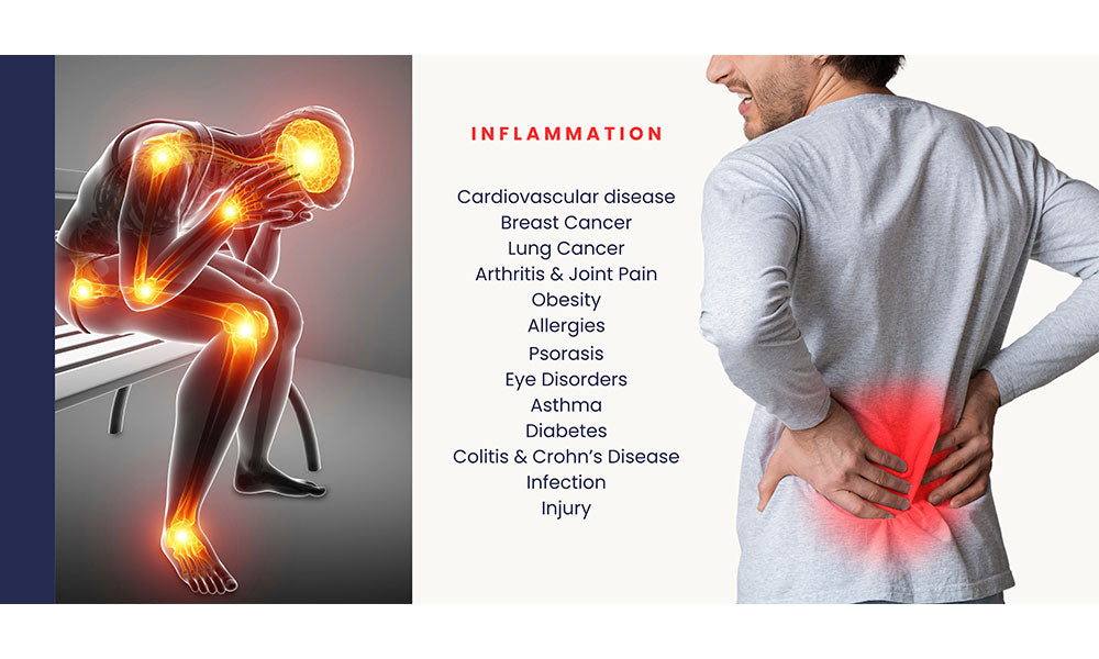 Reduces inflammation, helps prevent chronic inflammatory conditions (diabetes, cardiovascular diseases, cancer) and supports and improves detoxification processes